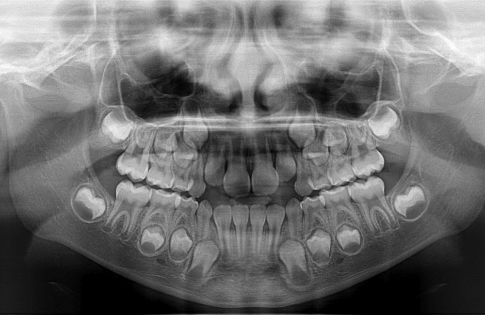 zdjęcia pantomograficzne - klinika stomatologiczna poznań materna dental