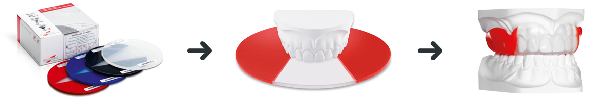 produkcja dopasowanego ochraniacza na zęby - klinika stomatologiczna poznań materna dental