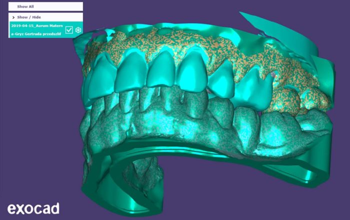 technologia CAD/CAM w protetyce - wiedza - blog - klinika stomatologiczna Poznań Materna Dental