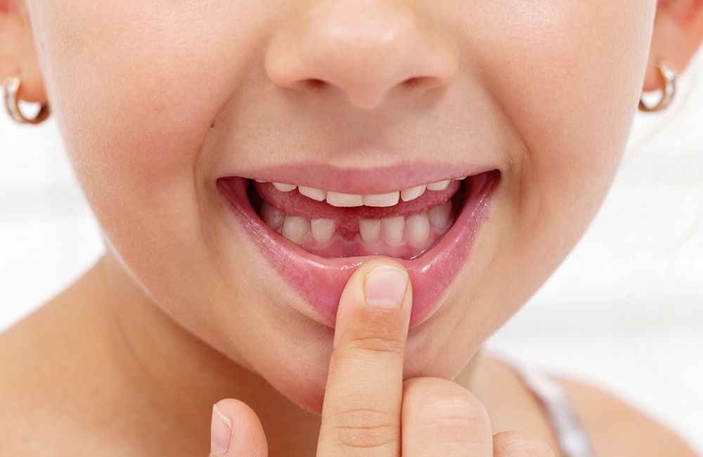 usuwanie zębów - klinika stomatologiczna poznań materna dental