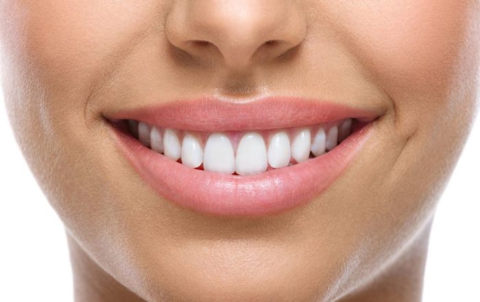wybielanie zębów lampą Beyond - wiedza - blog - klinika stomatologiczna Poznań Materna Dental