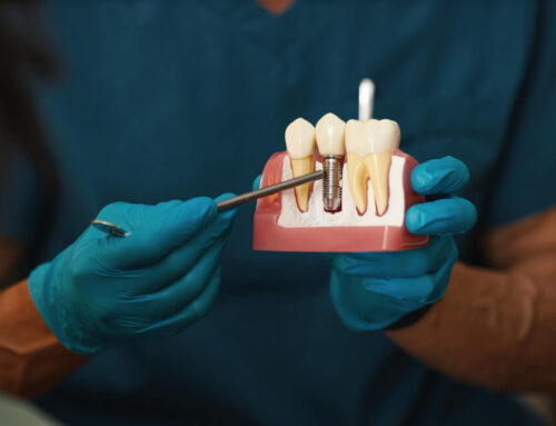 Dlaczego warto uzupełniać braki zębowe?