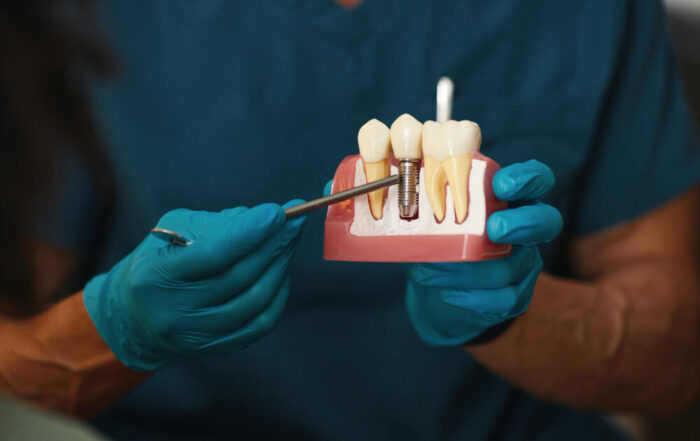 uzupelnianie-brakow-zebowych-blog-materna-dental
