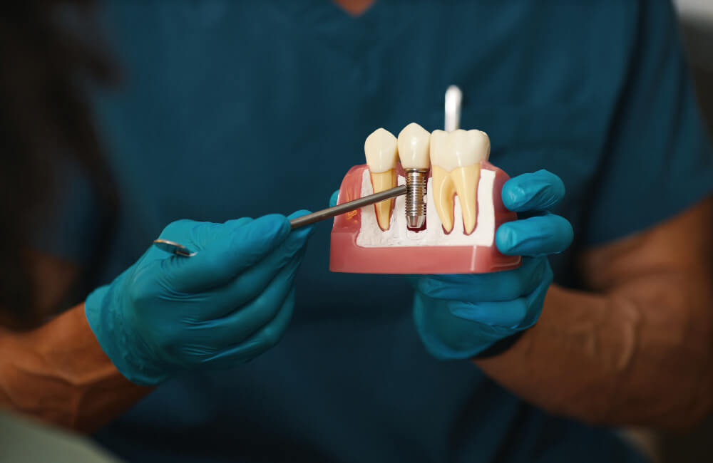 uzupelnianie-brakow-zebowych-blog-materna-dental