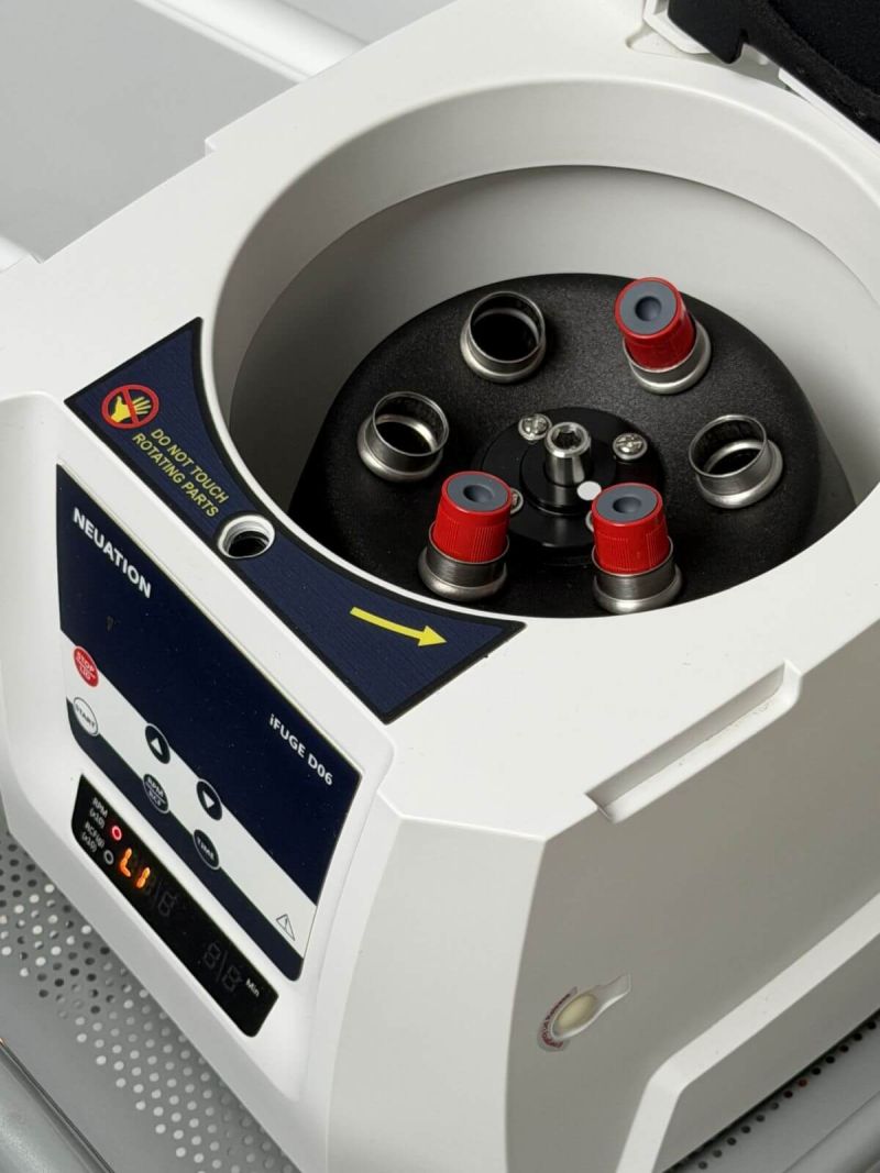 odbudowa-protetyczna-na-4-implantach-materna-dental-poznan-chirurgia-a