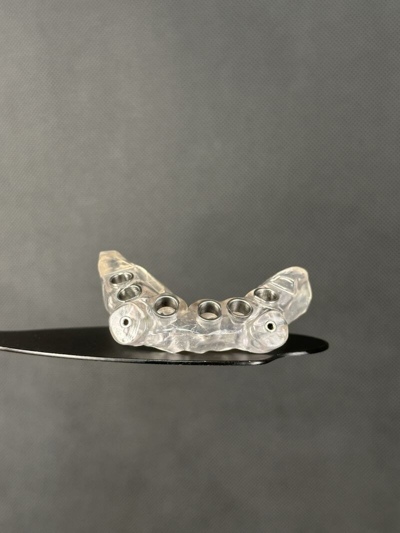odbudowa-protetyczna-na-4-implantach-materna-dental-poznan-chirurgia-implantologia-szablon1